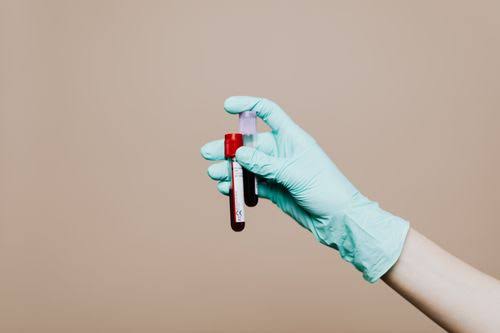 New Blood Test Research May Help Predict Cognitive Decline Years Before Symptoms Appear