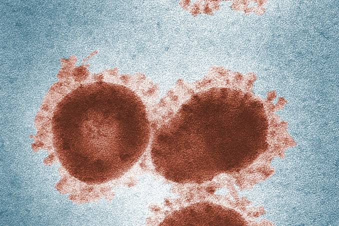 CDC Investigates Rising Cyclospora Infections as More Than 1,600 Cases Are Confirmed